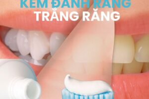 Top 5 kem đánh răng trắng răng tốt nhất