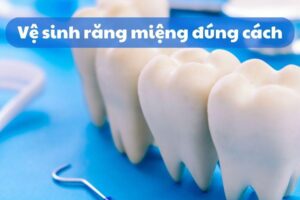 vệ sinh răng miệng đúng cách để sở hữu nụ cười rạng rỡ