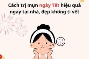 Cách trị mụn ngày Tết hiệu quả ngay tại nhà, đẹp không tì vết